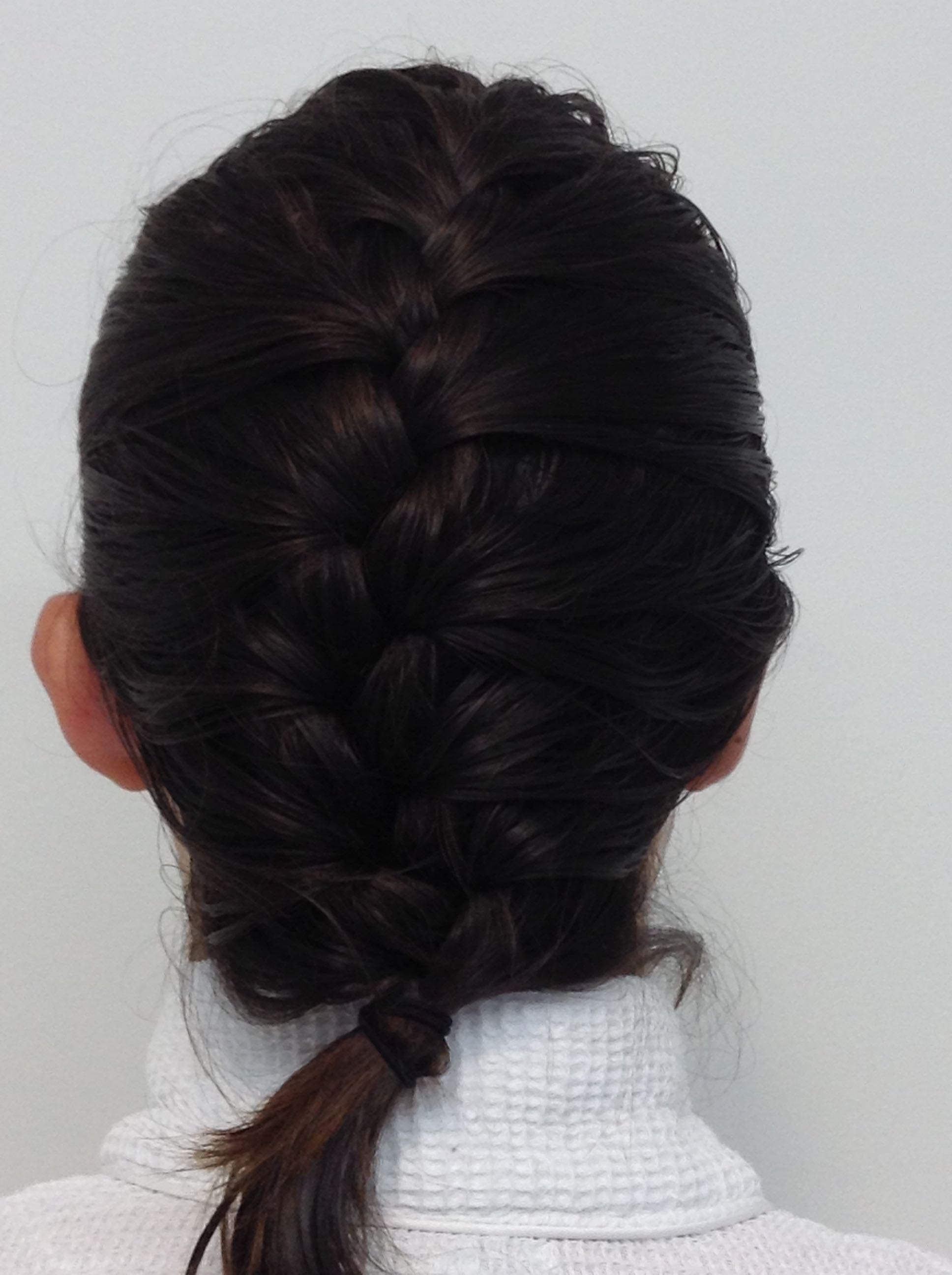 Otoplasty (Ear Pinning) clinical image 22