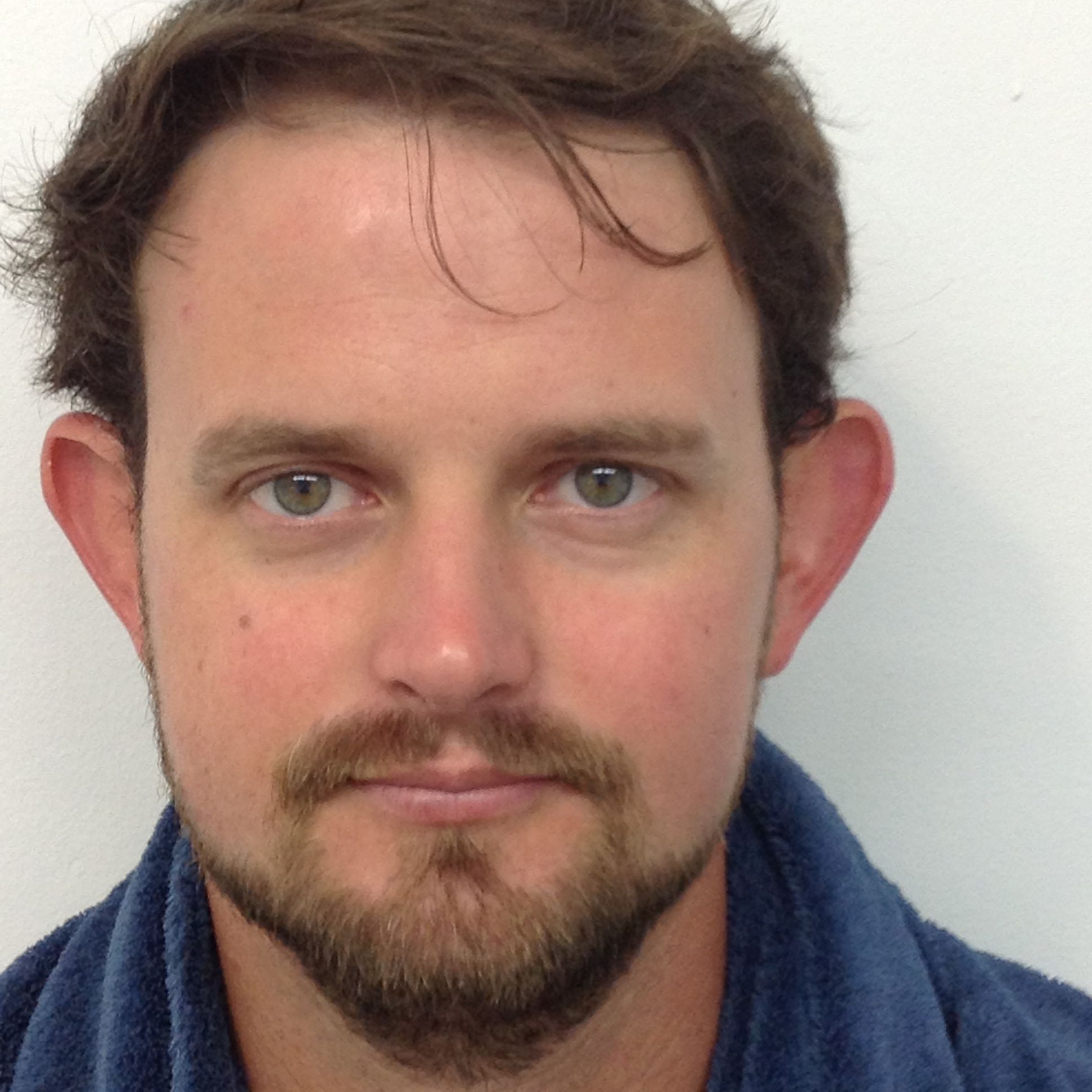 Otoplasty (Ear Pinning) clinical image 25