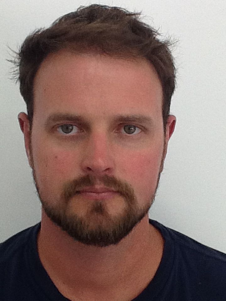 Otoplasty (Ear Pinning) clinical image 27